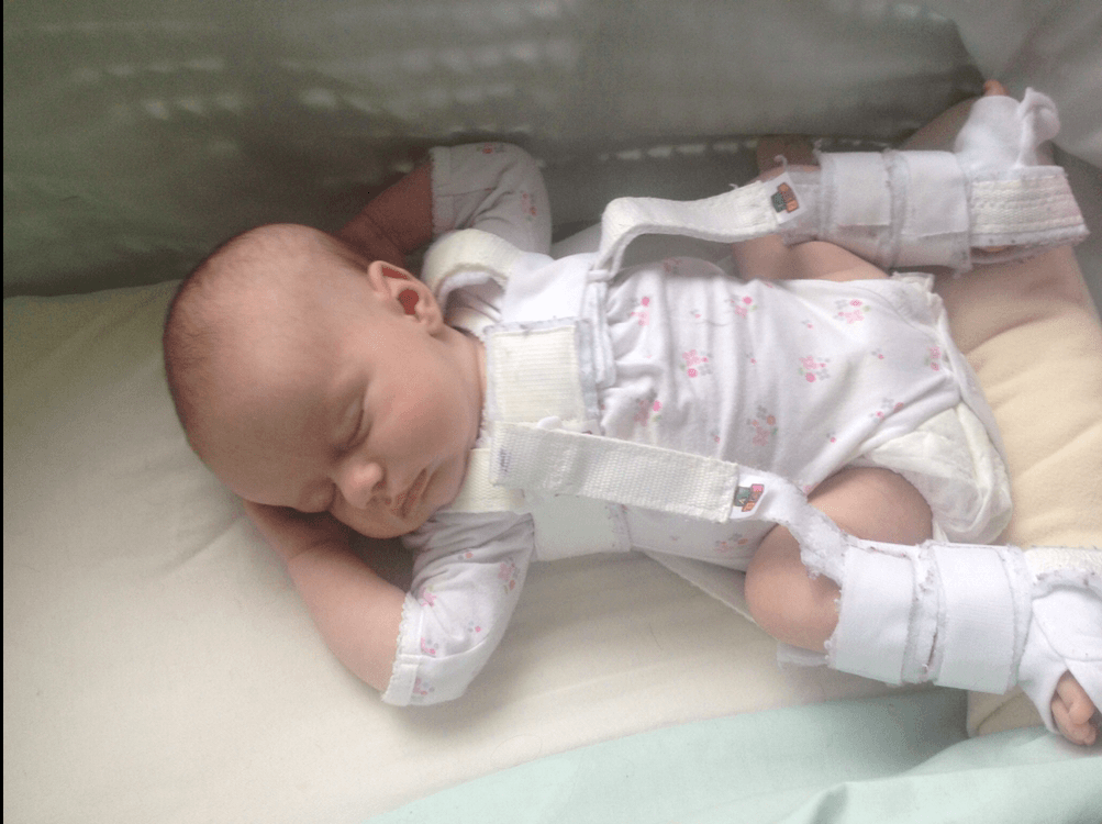 The Pavlik harness Mrs H.