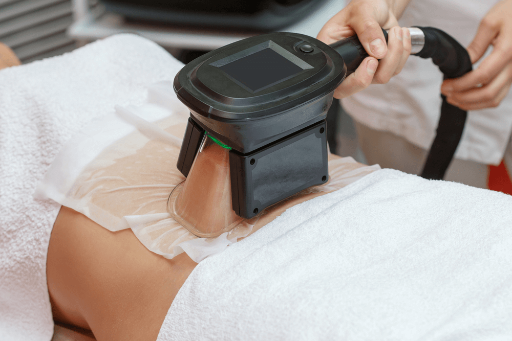How Does CoolSculpting Work?