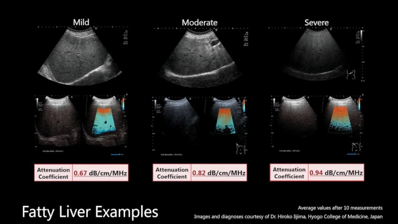 Introduction to Musculoskeletal Ultrasound Book Of MSK Ultrasound