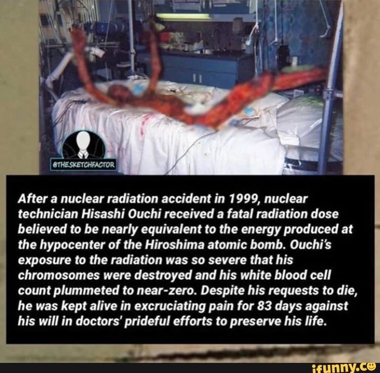 Hisashi Ouchi Rare Hospital Photos Reveal Effects of Extreme