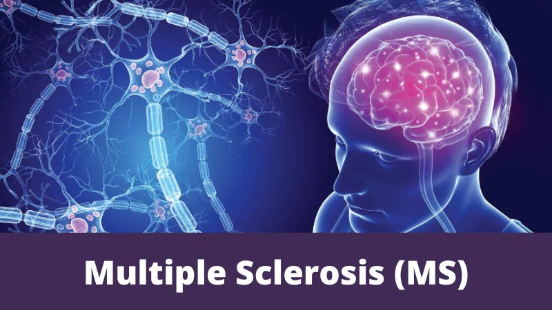 Multiple Sclerosis (MS) | MTHFR Support Australia