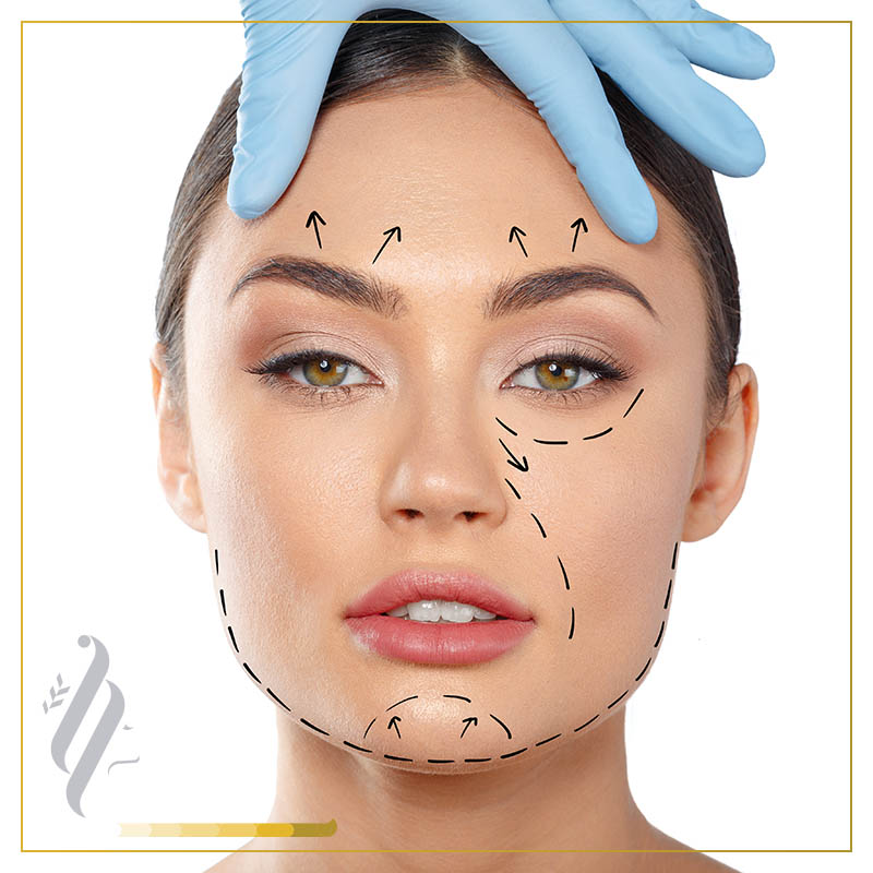 Radiesse ® Facial Mubarak Medical Center