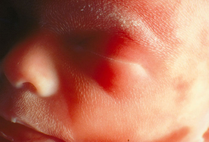 17 semanas de embarazo como saber si todo va bien