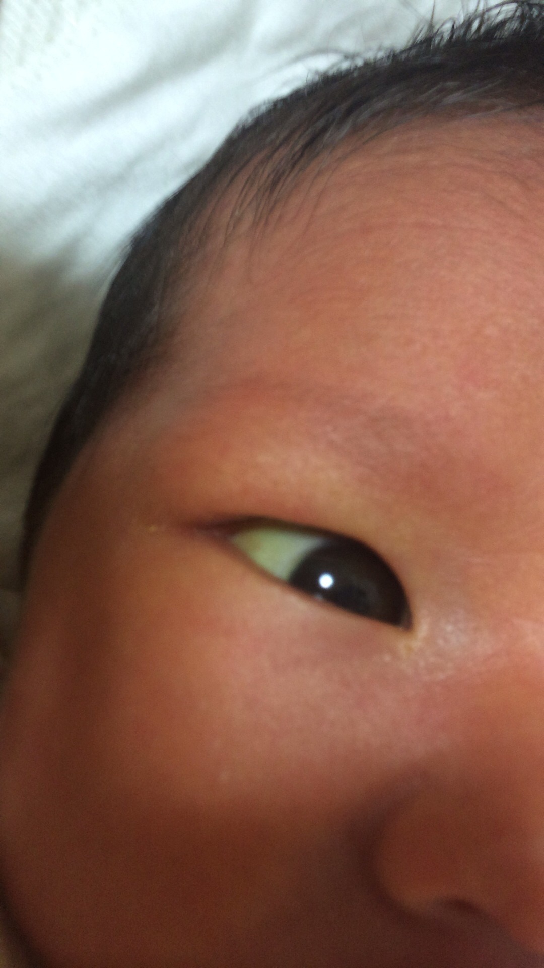 新生児の黄疸 育児 解決済み 【OKWAVE】