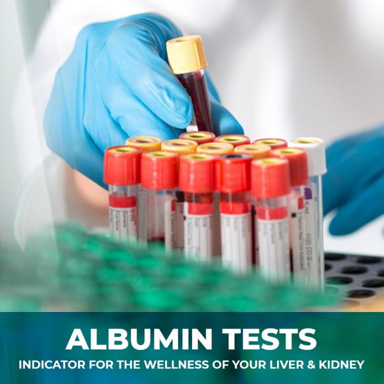 ALBUMIN TEST INDICATOR FOR THE WELLNESS OF YOUR LIVER & KIDNEY… PT