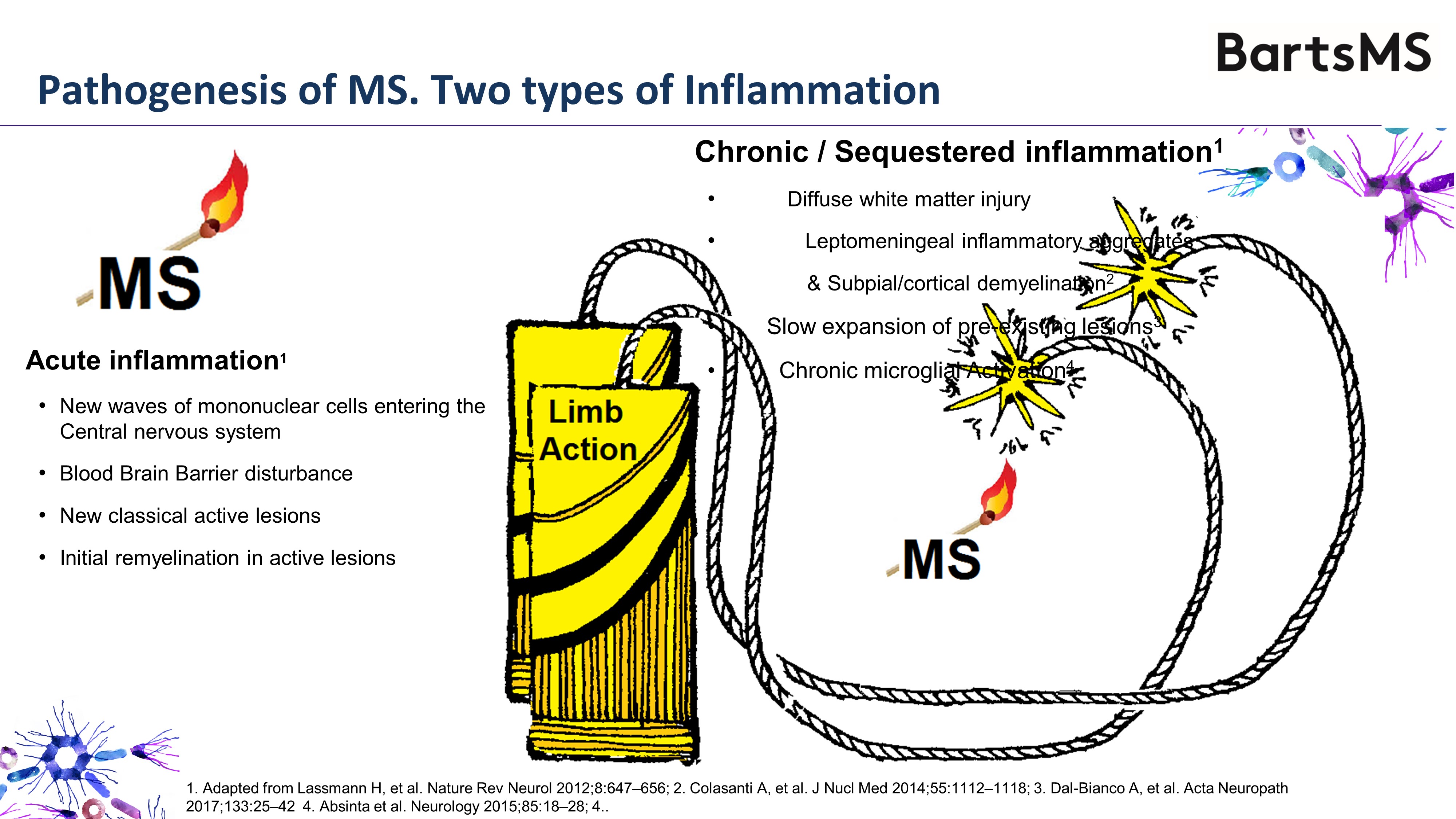 I’m on treatment, why am I getting worse Multiple Sclerosis Research Blog