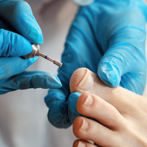 Foot Care Services Tillsonburg MultiService Centre