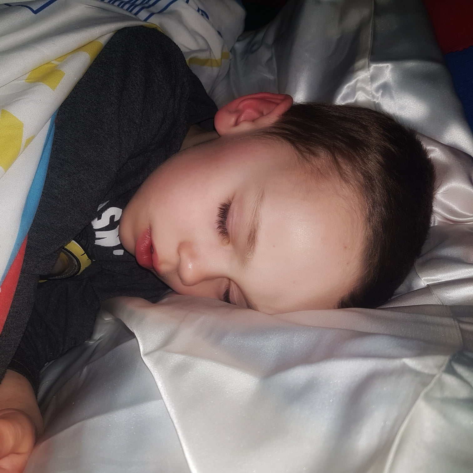 Alternative ways to improve eczema Mummy Fever