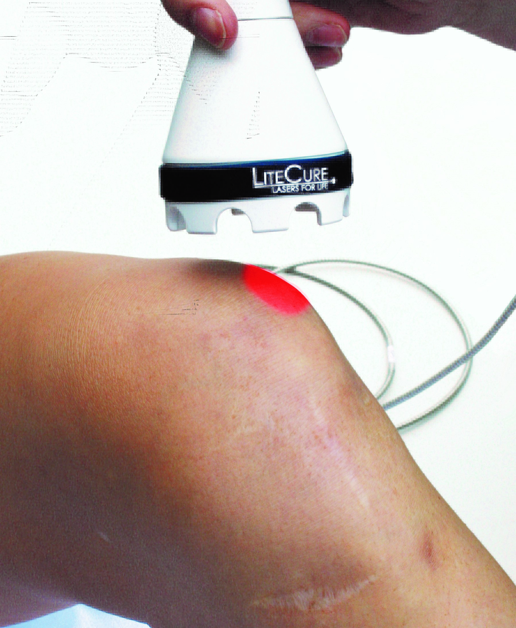 treatment_knee Murphy Chiropractic