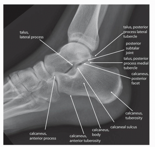 Diagnostic Imaging Techniques of the Foot and Ankle