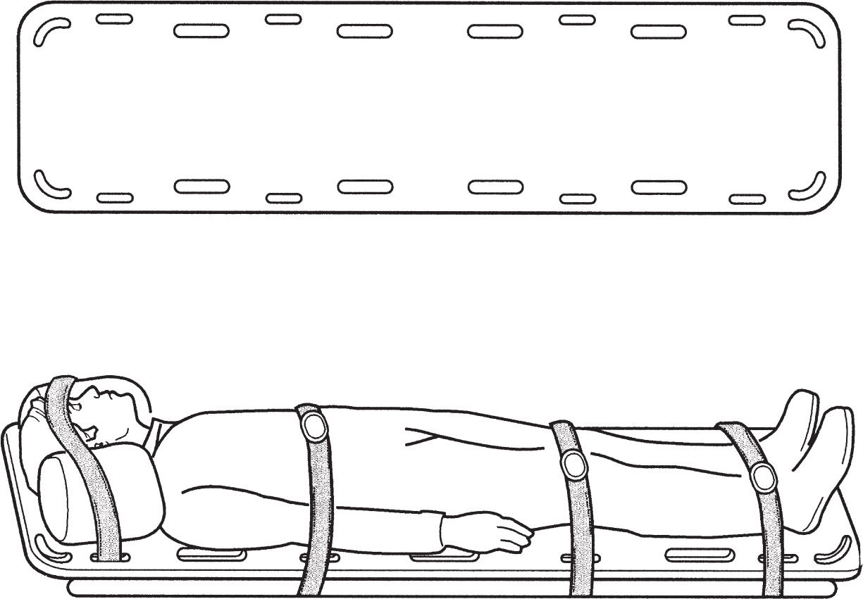 Common Types of Emergency Splints Musculoskeletal Key