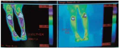 Clinical Practice and Research of Moxibustion Musculoskeletal Key