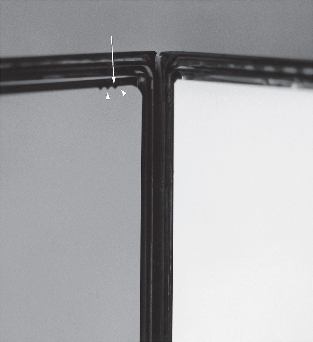 2 Film—Screen Radiography Musculoskeletal Key