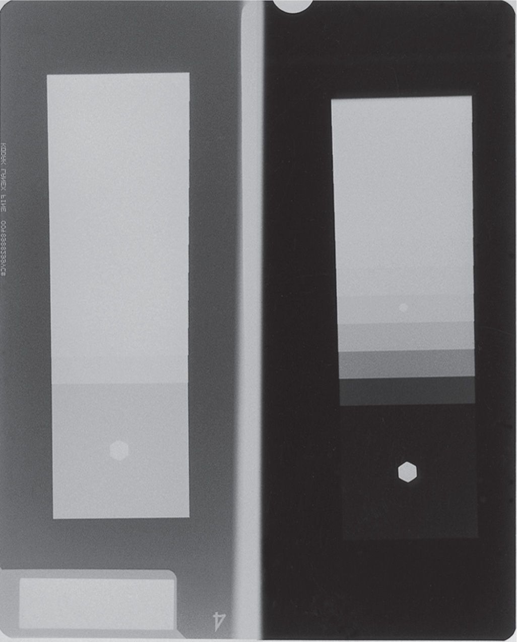 2 Film—Screen Radiography Musculoskeletal Key