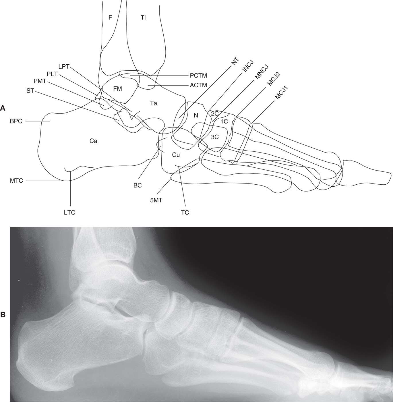 5 The Normal Foot and Ankle Musculoskeletal Key