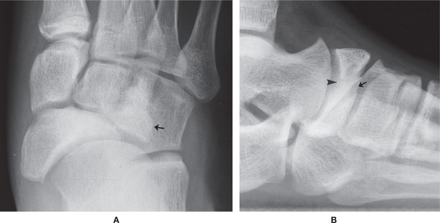 6 Normal Variants and Anomalies Musculoskeletal Key