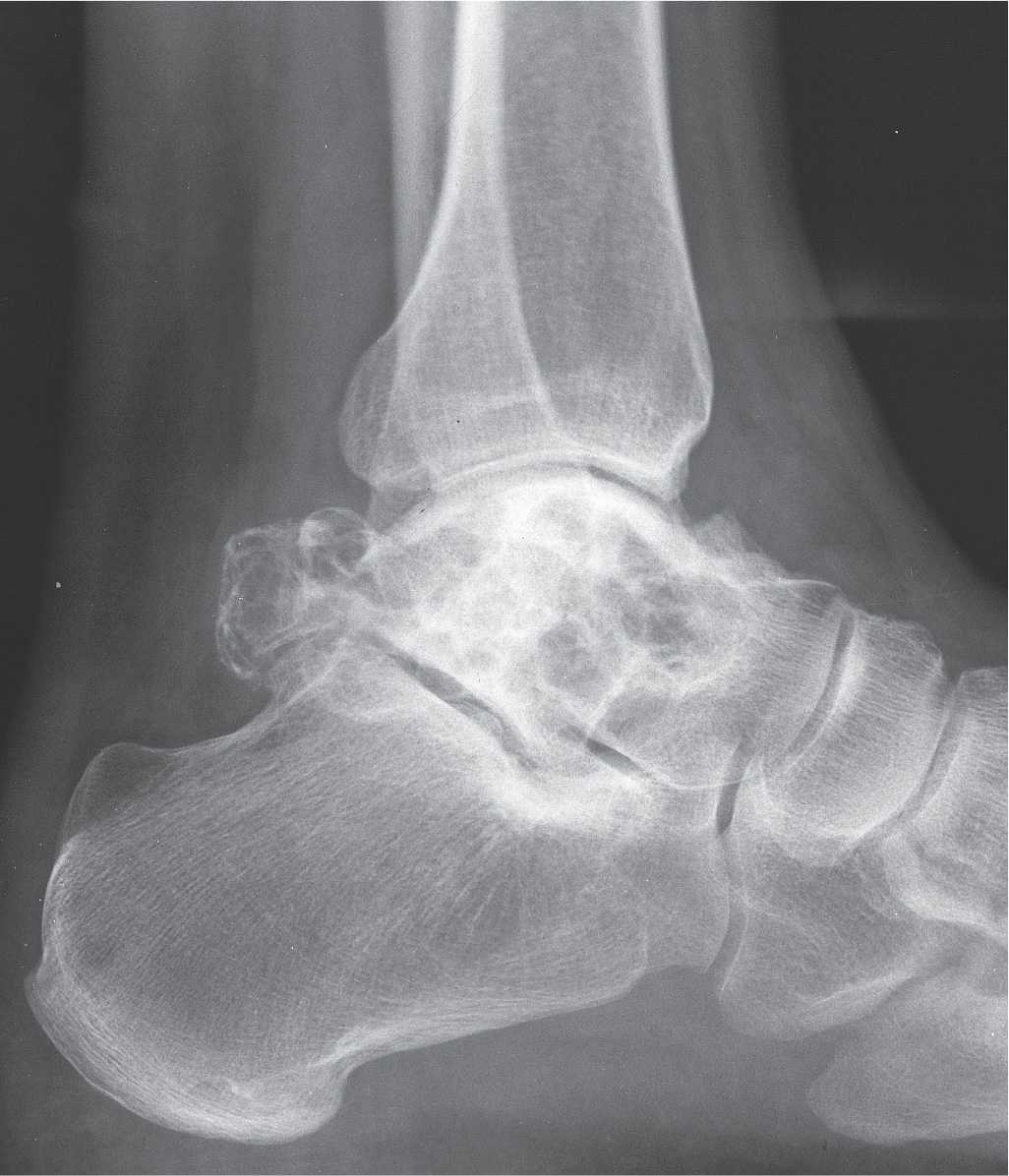 20 Tumors and Tumorlike Lesions Musculoskeletal Key