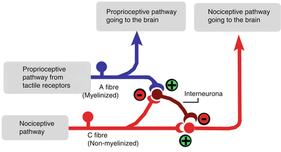 Physiology and Rehabilitation of Sensorial and Motor Disorders ...