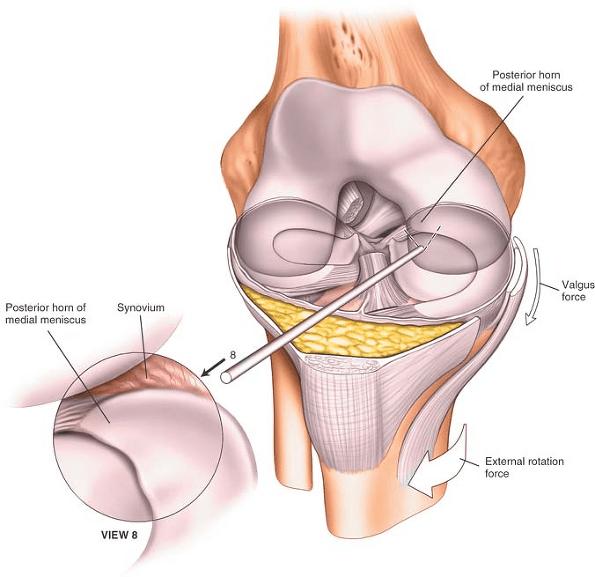 The Knee Musculoskeletal Key