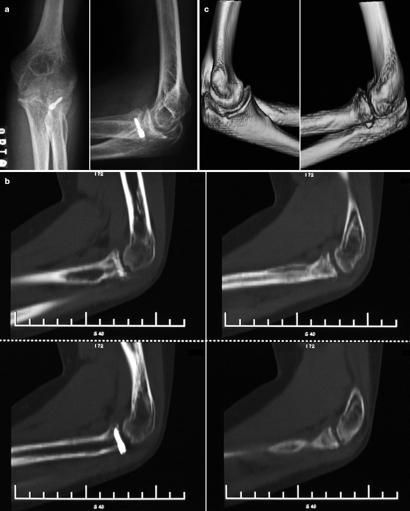 Accidental and Nonaccidental Articular Injuries in the Skeletally