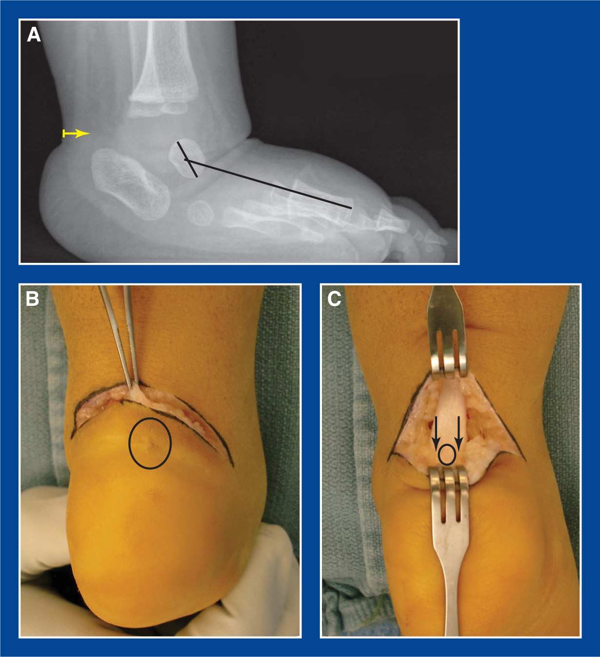 Soft Tissue Procedures Musculoskeletal Key