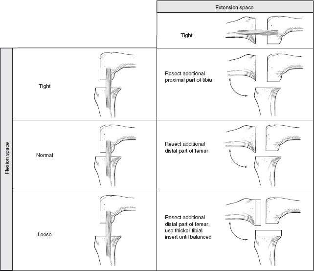 Balancing the Flexion and Extension Gaps in Revision Total Knee