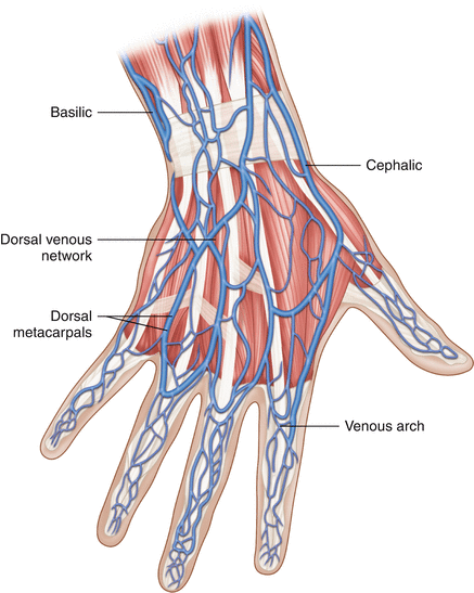 Replantation at the Level of the Radiocarpal Joint ... diagram of tendons in forearm 