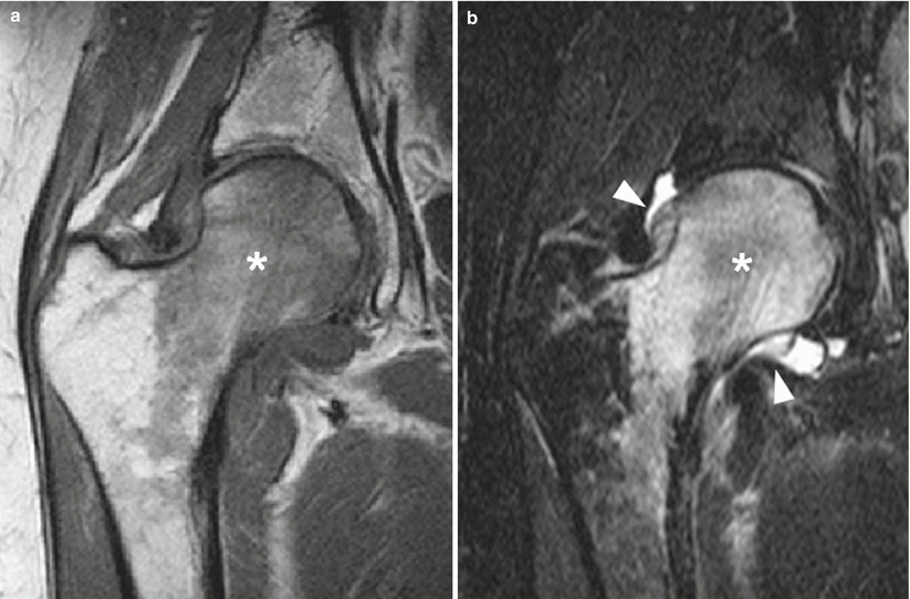 Hip Musculoskeletal Key