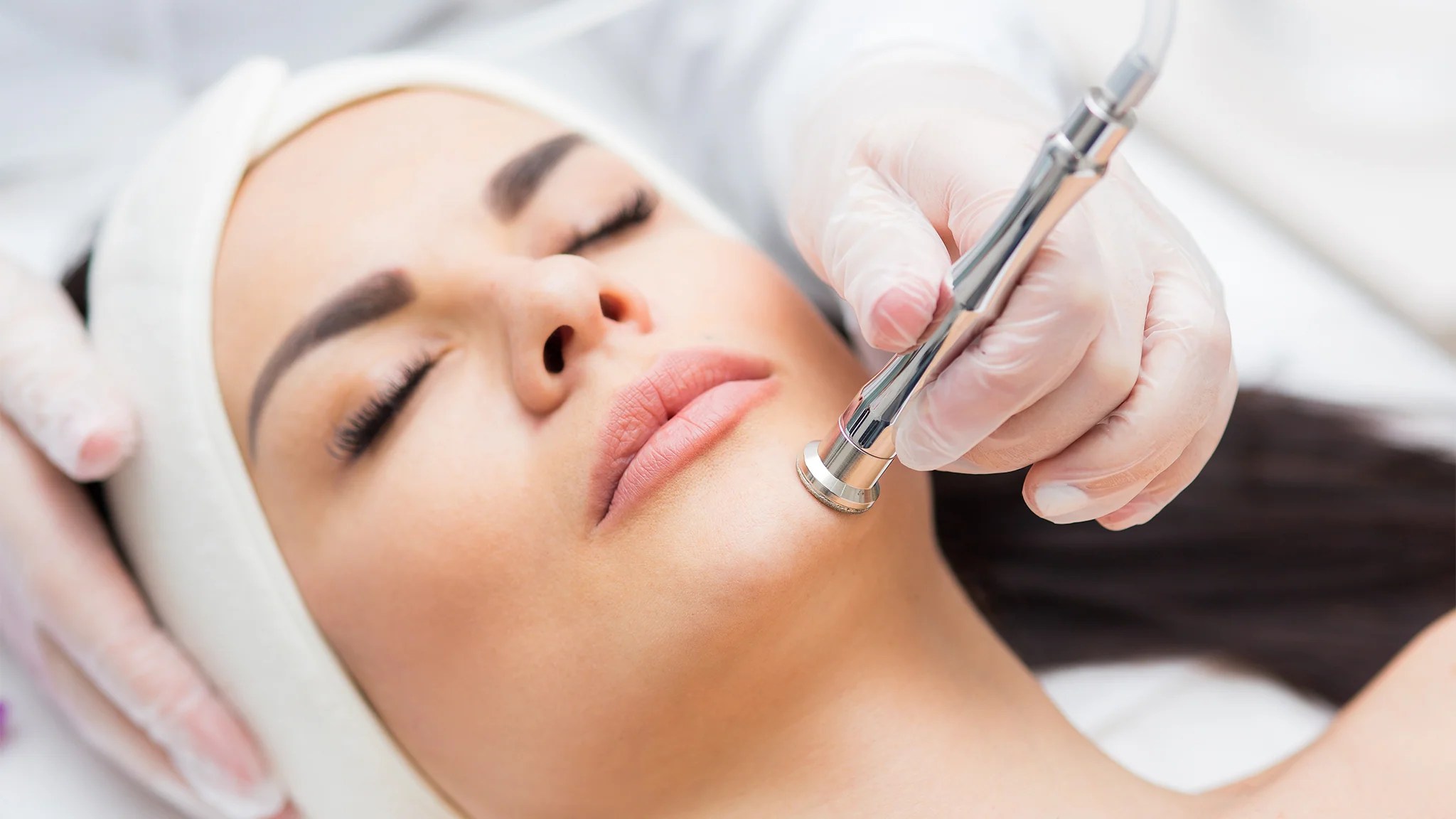 ¿Cómo funciona la microdermoabrasión facial? onpost mx