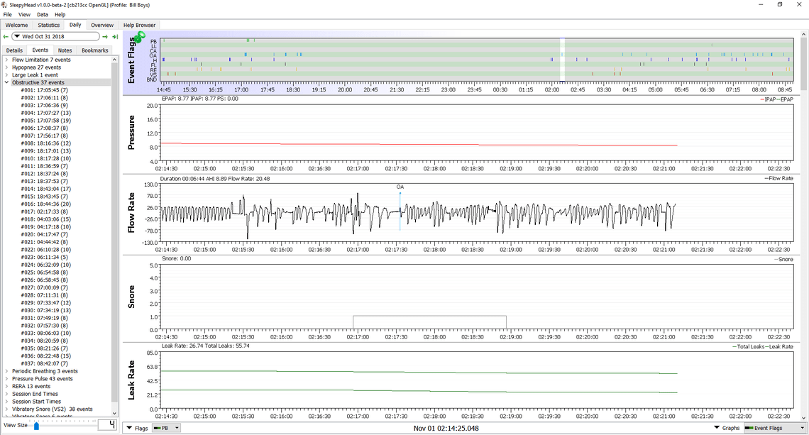 Clear Airway Apnea increases as OAA decreases MyApnea