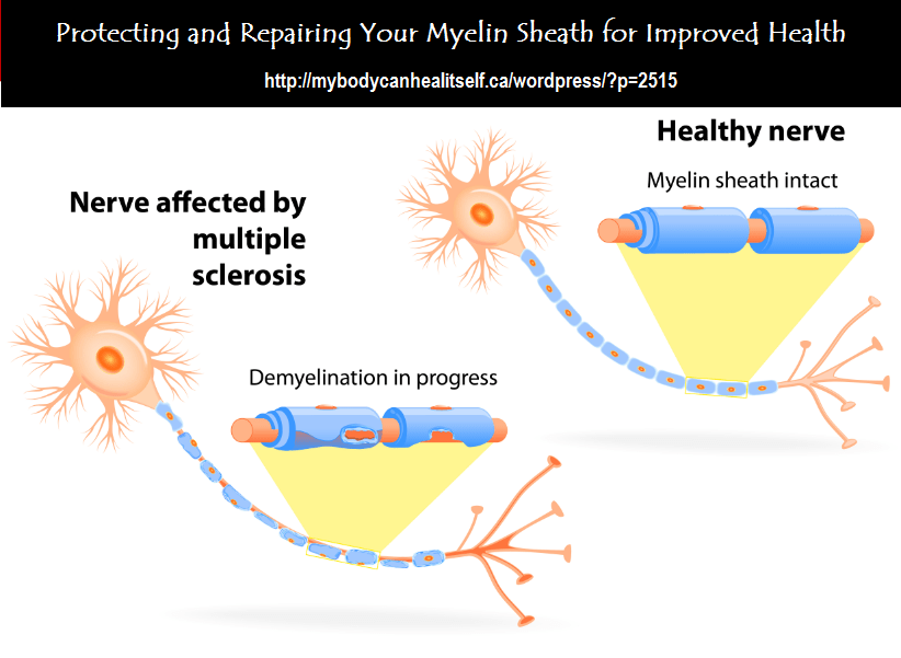 NATURAL CURES Protecting and Repairing the Myelin Sheath for Improved Health Health by Design