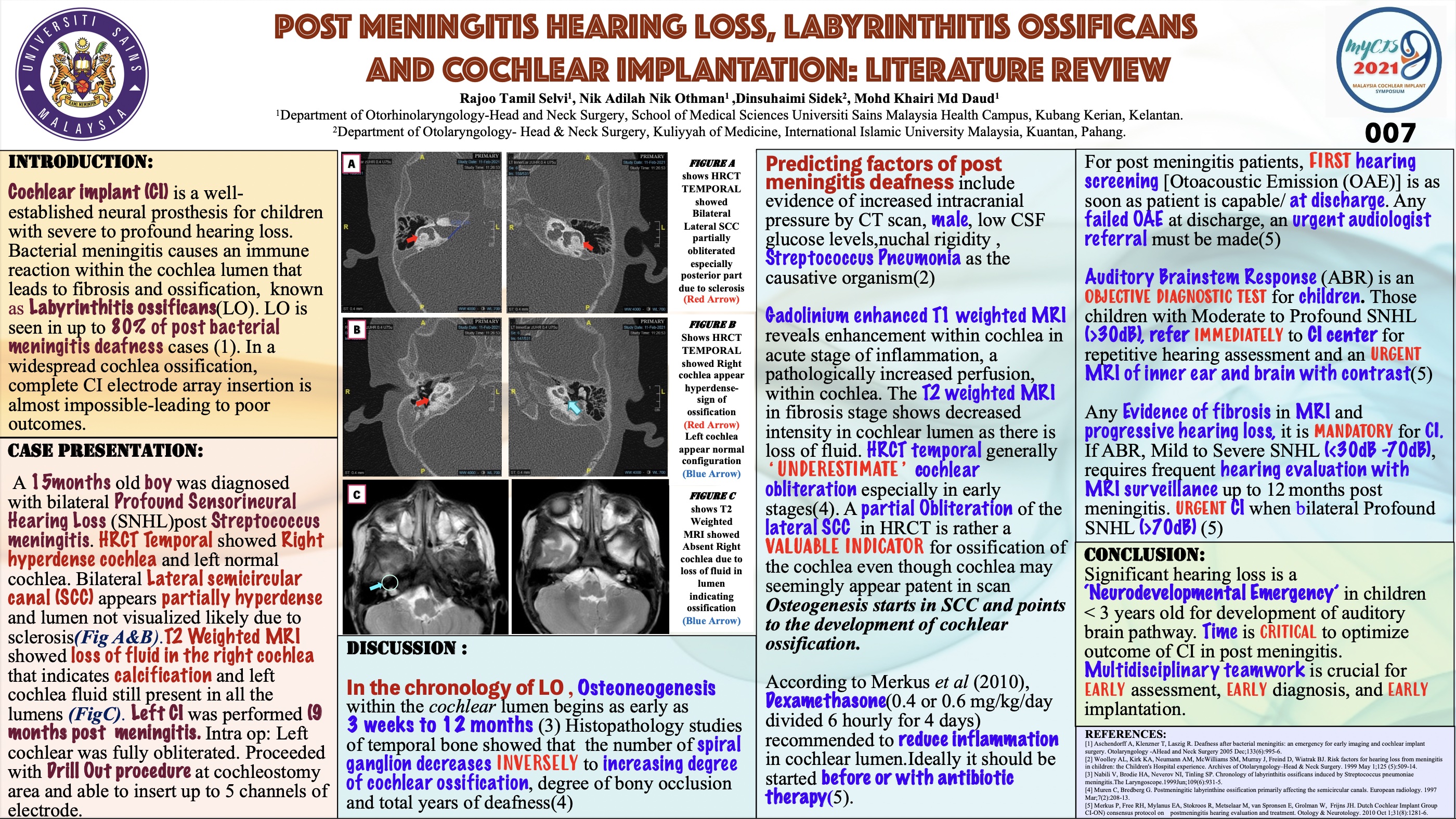POST MENINGITIS HEARING LOSS, LABYRINTHITIS OSSIFICANS AND COCHLEAR