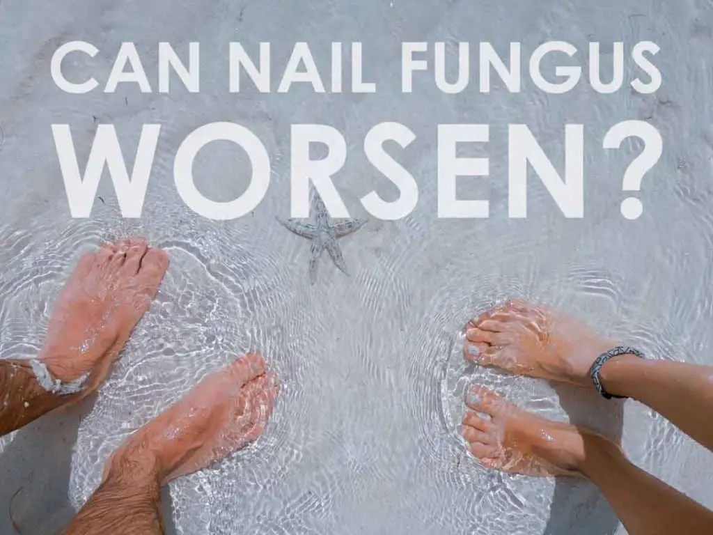 Why You Should Know If The Ocean Can Kill Toenail Fungus My Clean Nails