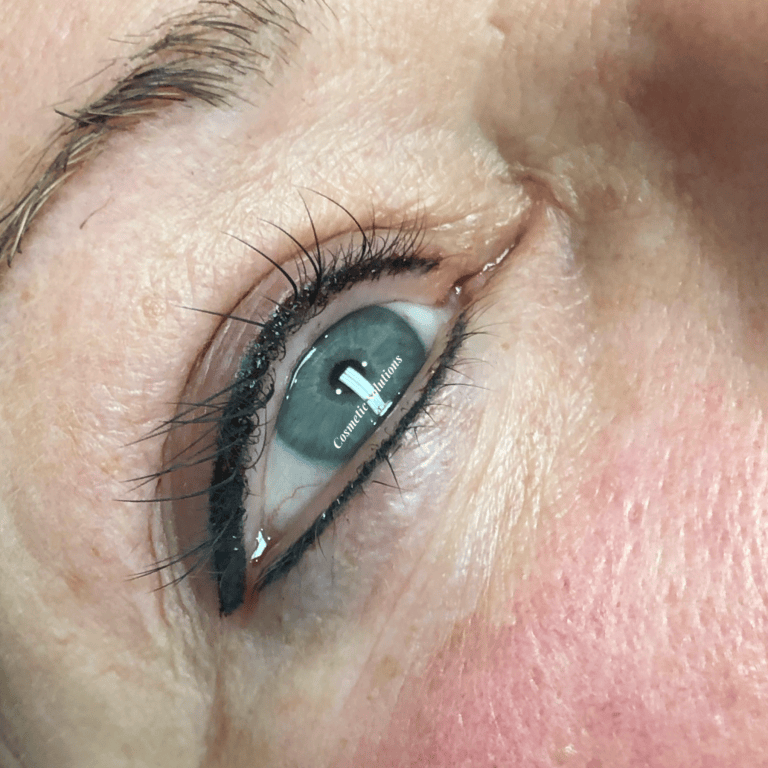 Permanent Eyeliner My Cosmetic Solutions