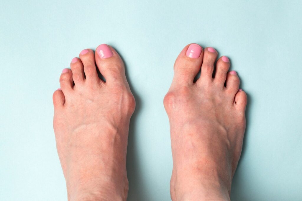 Foot pain top 10 causes