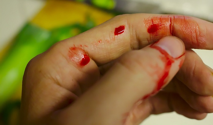 Dreams About Bleeding Meaning and Interpretation