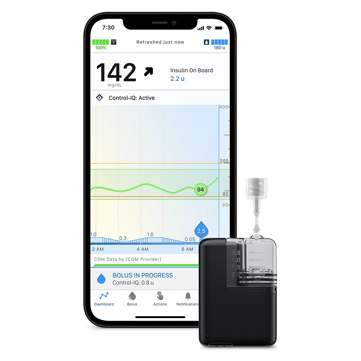 Tandem Mobi System | MyEHCS