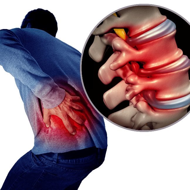 Genesis Medical Clinic Chronic Back Pain Relief Genesis Medical Clinic