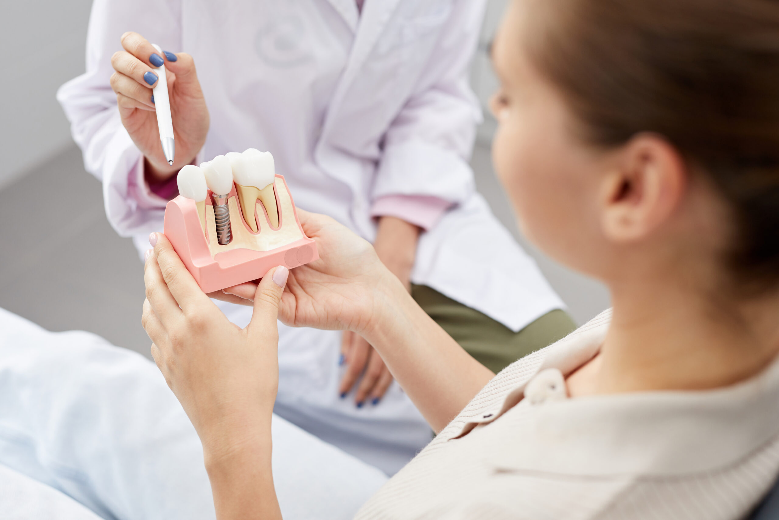 Caring for Your Dental Implants Gentle Dentistry