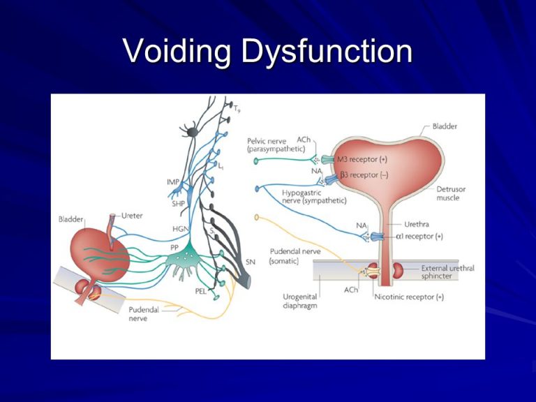 Voiding Dysfunction Treatment for Female My Gynae