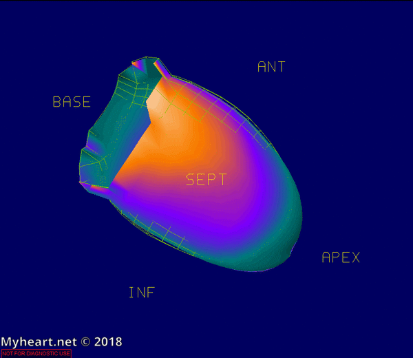 Heart Function Including Ejection Fraction (EF) • MyHeart