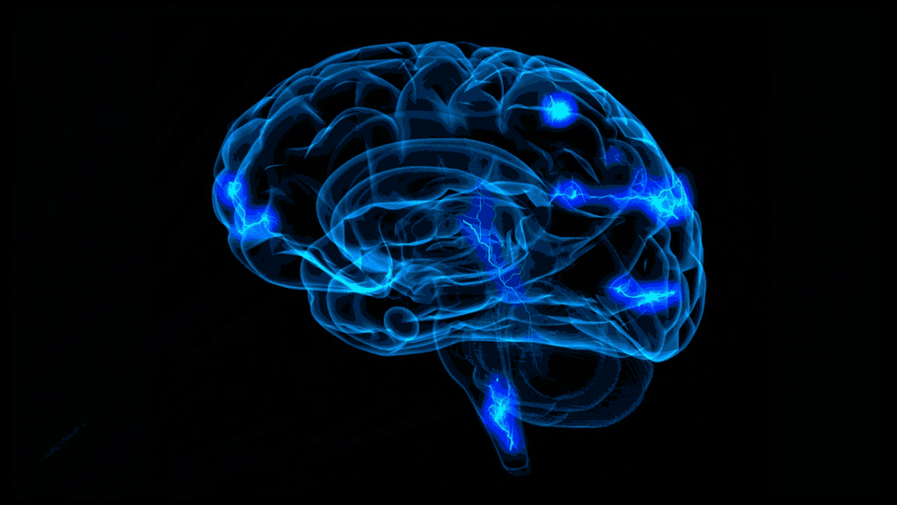 Stroke What You Need to Know • MyHeart