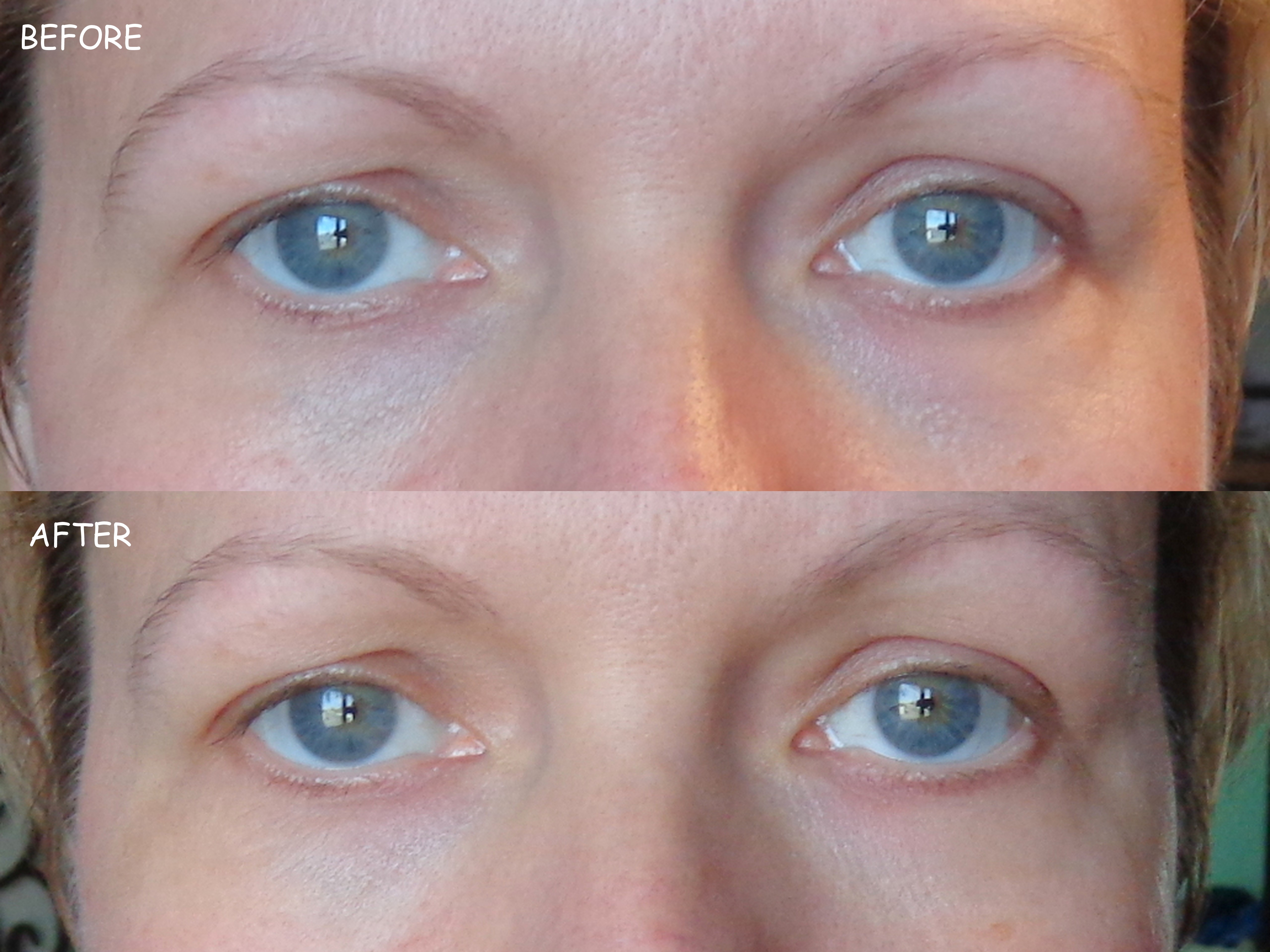 Sudden Change Brings Results for Your UnderEye Area My Highest Self