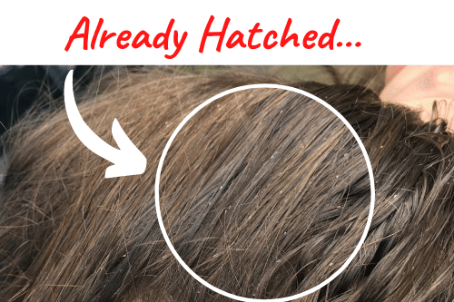Dead vs Live Nits Color of Lice Eggs My Lice Advice