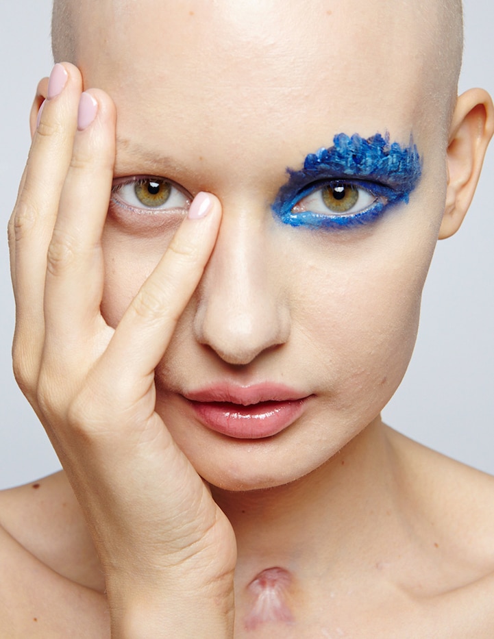 Cancer Survivor Returns to Modeling after Losing 95 of Her Jaw My