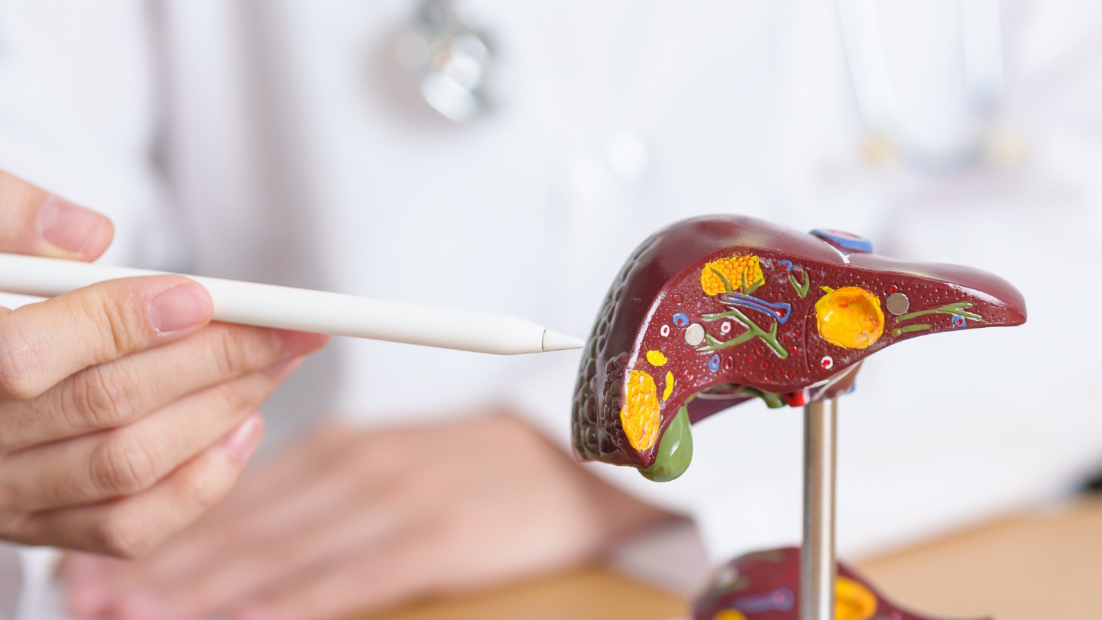 Can Diet Cause Raised Liver Enzymes? My Pet Nutritionist