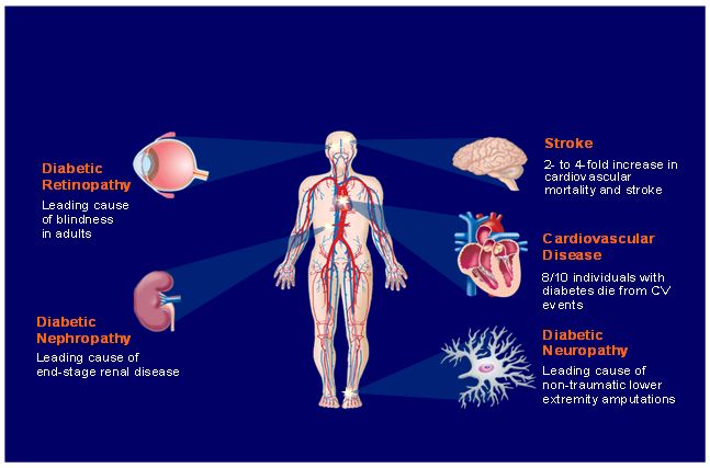 Web what happens in type 2 diabetes mellitus? Web the main subtypes of dm are type 1 diabetes mellitus (t1dm) and type. Type 2 Diabetes Diagnosis And Consequences My Remedy Source
