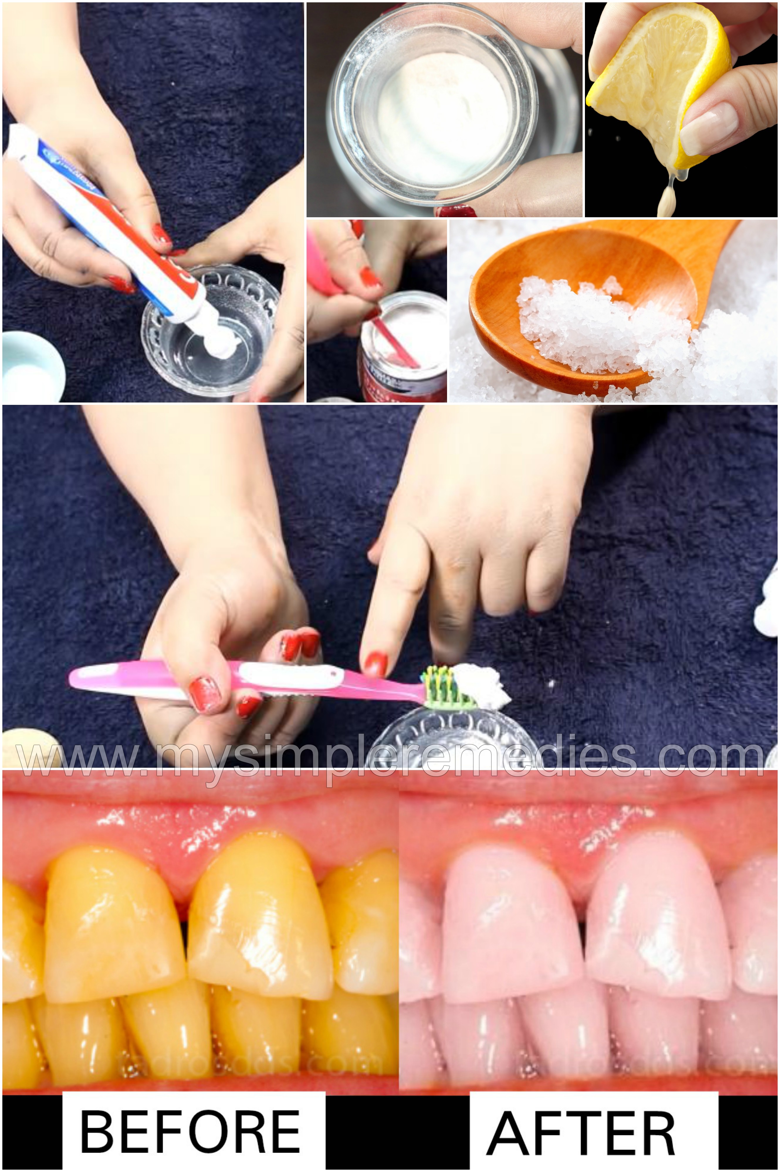 How To Whiten Your Teeth Naturally At Home Quickly & Instantly