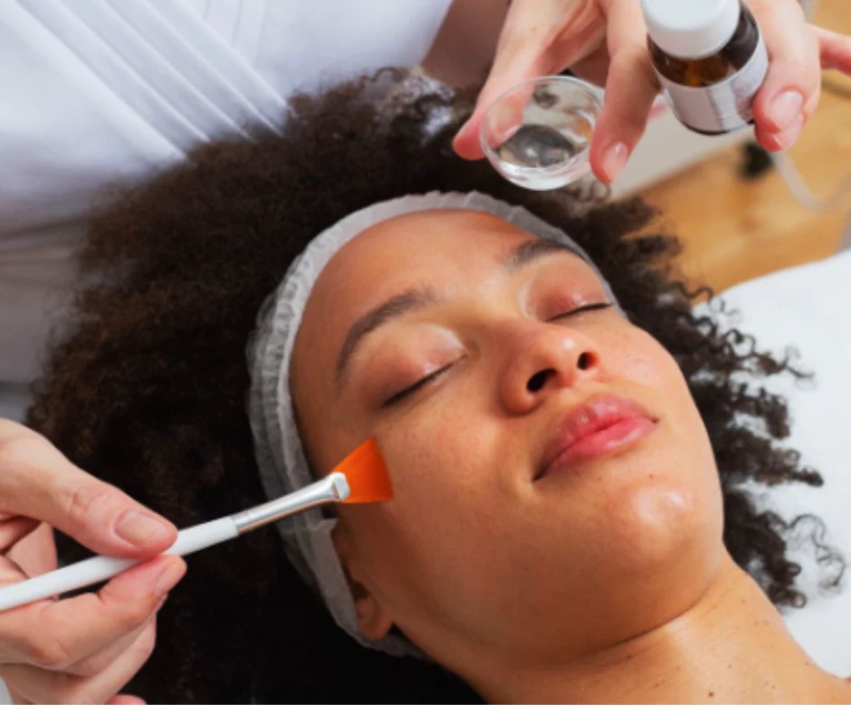 Unlocking Clear Skin The Power of Chemical Peels for Blackhead Remova