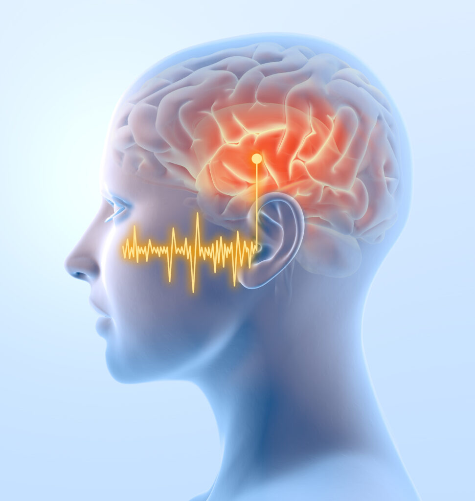 Tinnitus, Hyperacusis and Sound Therapy Sound Therapy International